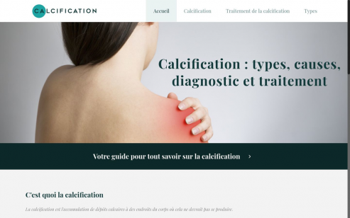 https://www.calcification.fr